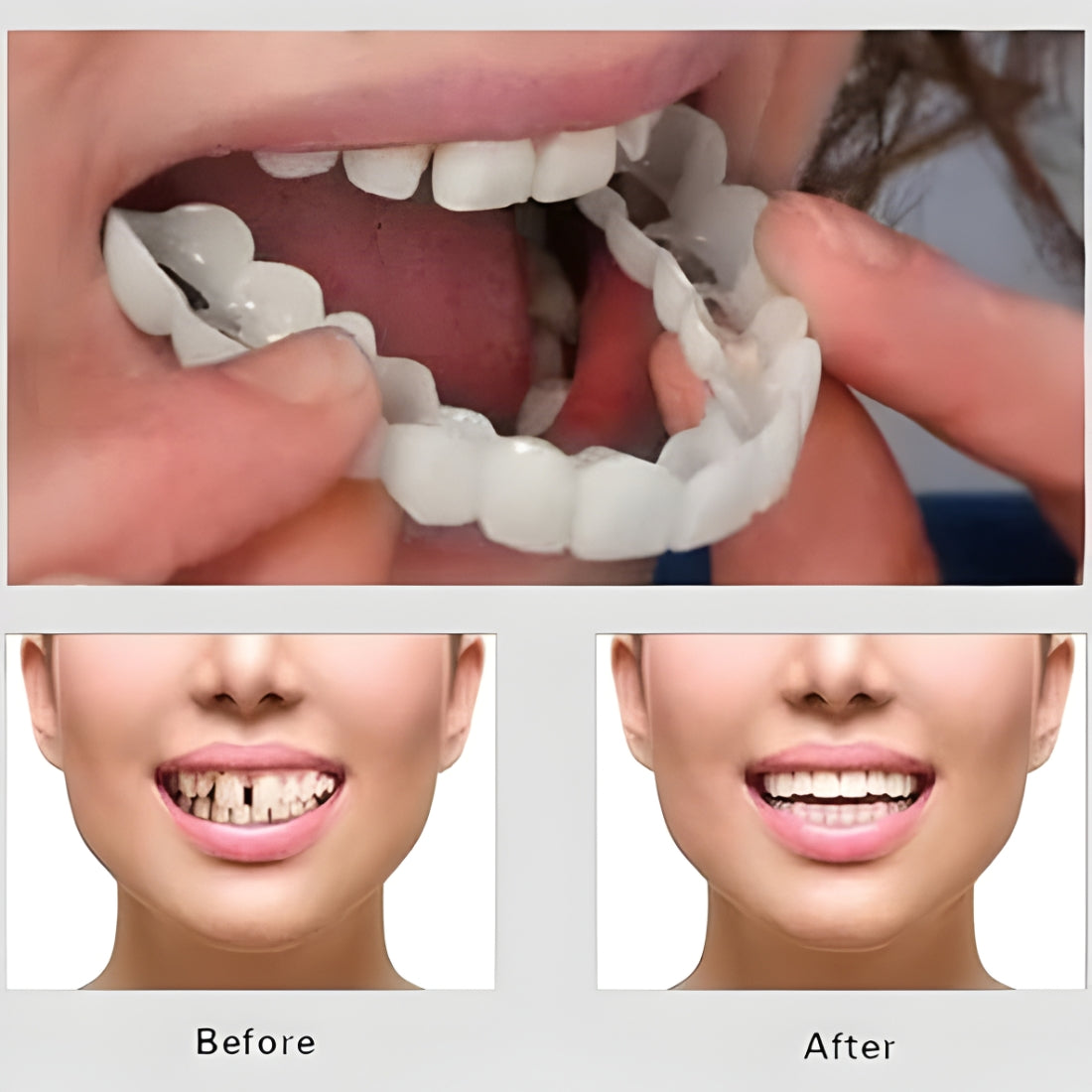 2PC Adjustable Snap On Smile Veneers Teeth For Men And Women