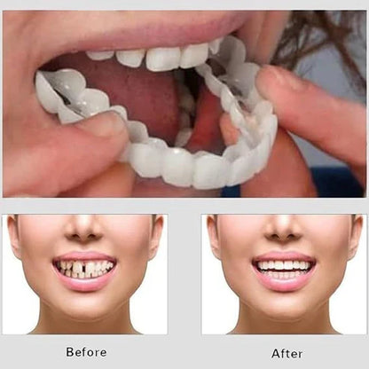2PC Adjustable Snap On Smile Veneers Teeth For Men And Women